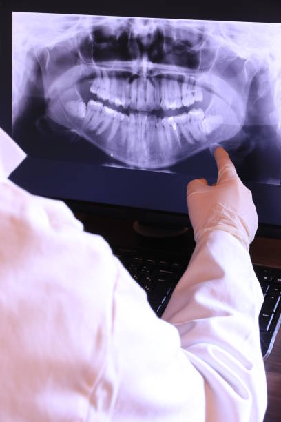 Best Emergency Dental Surgery in Warren, OH